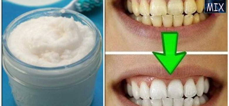 Как отбелить зубы в фотошопе